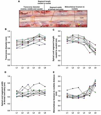 The Role of Functional Neuroanatomy of the Lumbar Spinal Cord in Effect of Epidural Stimulation